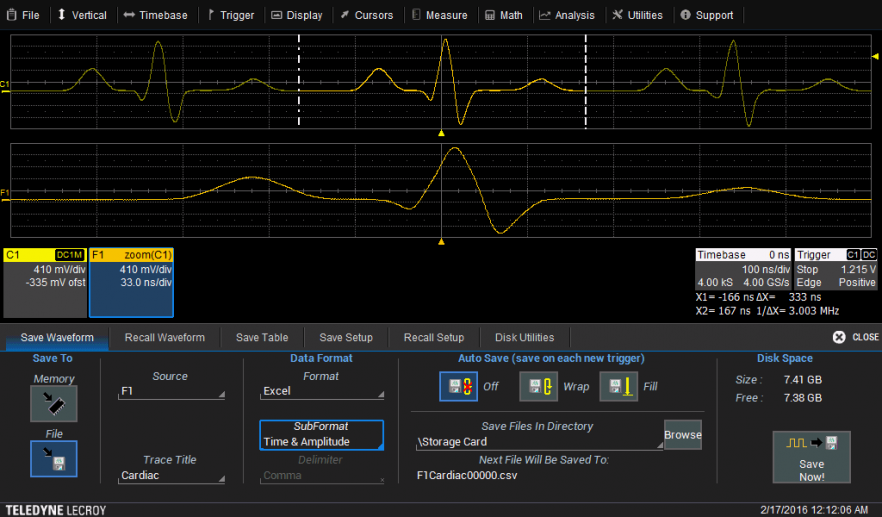Abbildung 5 – Save Now! Im Format csv mit Zeit und Amplitude in die Datei F1Cardiac00000.csv.
